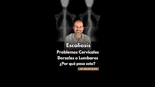 ESCOLIOSIS Problemas Cervicales Dorsales y Lumbares ¿Por qué pasa esto [upl. by Eupheemia934]