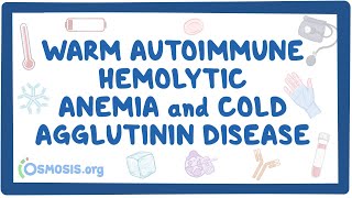 Warm autoimmune hemolytic anemia and cold agglutinin NORD [upl. by Noellyn]