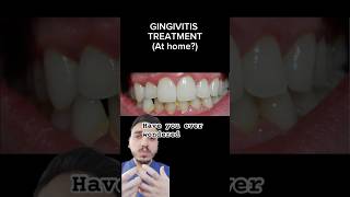 GINGIVITIS AT HOME TREATMENT gumdisease periodontist gumdisease [upl. by Yetah]