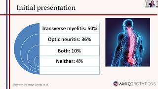 Zubia Kahn  Neuromyelitis Optica Spectrum Disorder [upl. by Werdn276]