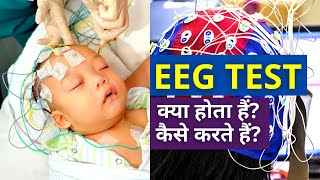 EEG Test for Brain in Hindi  EEG Test क्या होता हैं कैसे करते हैं [upl. by Tristis]