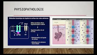 La mucoviscidose  physiopathologie [upl. by Ocihc]