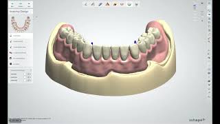 Novaloc® Digital – How to do the Implant Level Design [upl. by Derrek126]