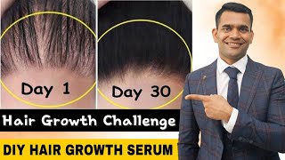 Powerful Hair Growth Serum For Extreme Hair Growth  Regrow Lost Hair Get Double Density in 30 days [upl. by Ahseit]