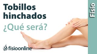 ¿Tienes los tobillos y piernas hinchadas  ¿Será edema venoso o linfático [upl. by Winther325]