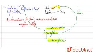 Given in the box are certain disorders of human body Asthma Cyanosis Blue baby [upl. by Slaohcin]