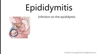 Epididymitis [upl. by Ididn396]