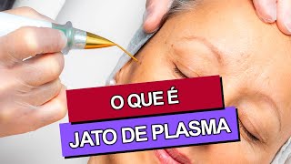 JATO DE PLASMA Antes e Depois [upl. by Namus]