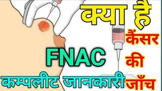 Fnac test in hindi Fine needle Aspiration Cytology test report procedureFNAC और BIOPSY मे अंतर [upl. by Rma]