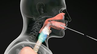 How do Straw Exercises Help the Voice Get Better voicetherapy [upl. by Grimaldi]