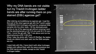 Gel electrophoresis faint bands [upl. by Attekal185]