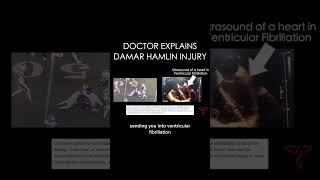 DOCTOR explains Damar Hamlin Collapse [upl. by Abramo589]