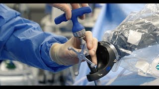 Image Guided Neurosurgery  Robotic Spine Surgery in Coeur dAlene Idaho [upl. by Ominoreg]