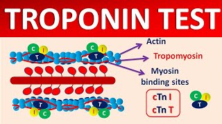 Troponin test and its significance [upl. by Arabrab]