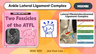 Ankle and Foot02 Two fascicles of the anterior talofibular ligament ATFL [upl. by Lemal]