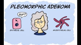 Pleomorphic Adenoma [upl. by Gaskins]