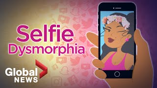 Selfie Dysmorphia How social media filters are distorting beauty 🤳🏽 [upl. by Asirrac]