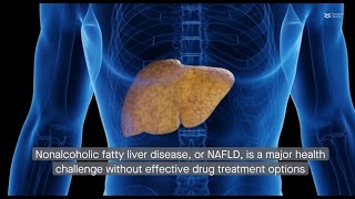 Novel SCD1 inhibitor promising against nonalcoholic fatty liver disease [upl. by Nova814]