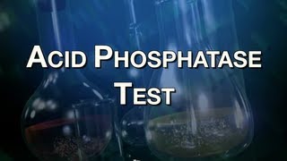 Acid Phosphatase Test [upl. by Uriel16]