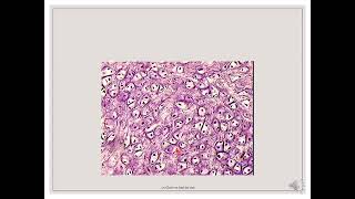 Histology Slides Series Episode 4  Cartilages and Bone [upl. by Humphrey]