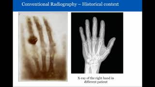 Introduction to Radiology Conventional Radiography [upl. by Otsenre]