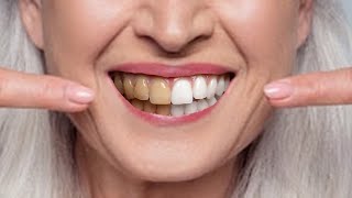 11 Natural Ways to Whiten Teeth at Any Age [upl. by Aliza]