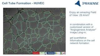 Cell Tube Formation  HUVEC on Matrigel [upl. by Ocinom]