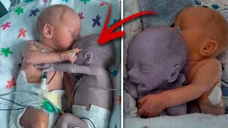 Mom puts the baby to the dying Twin and five minutes later a real Miracle happens  PLOT [upl. by Enihpled]