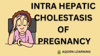 Intrahepatic Cholestasis of PregnancyICP  aqorn learning  rahat2021 [upl. by Ettesel]