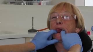 Definitive mandibular impression for complete denture [upl. by Nirda]