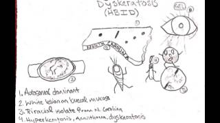 Hereditary Benign Intraepithelial Dyskeratosis [upl. by Yoj]