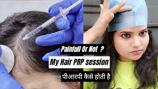 My hair PRP treatment  hair loss solution [upl. by Barrett]