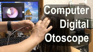 Computer Digital Otoscope for Home or Medical Office [upl. by Nhar]