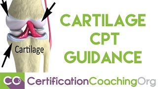 Cartilage CPT Guidance Excision — CPT Coding Question [upl. by Salvatore15]