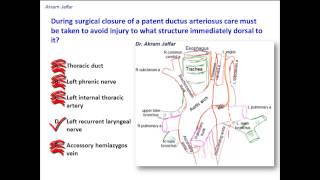 What structure is immediately dorsal to the ligamentum arteriosum [upl. by Attalanta]