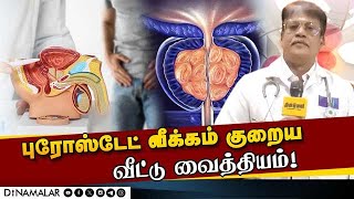 சொட்டு சொட்டாக சிறுநீர் கழிக்கிறீர்களா  ஆண்களே உஷார்  Prostate Enlargement  Prostate treatment [upl. by Ordisi]