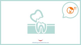 Denti che si rompono in seguito a devitalizzazione [upl. by Notnad]