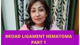 Broad Ligament Hematoma Part 1 [upl. by Ennyl]