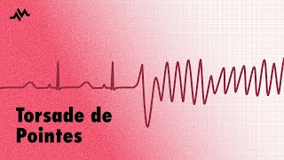 Torsade de Pointes  EKG ECG Interpretation [upl. by Gaspar]