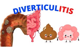 What is Diverticulitis A Brief Overview causes and Treatment [upl. by Teyugn]