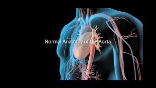 Aortic Aneurysm and Aortic Dissection [upl. by Pammi857]