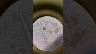 Hookworm adultworm microbiology parasitology stool microscopy [upl. by Manheim707]