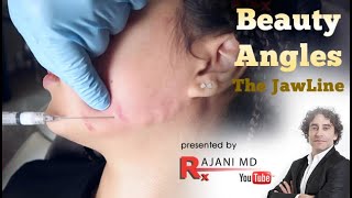 How to Create Beauty Angles  Filler Injections Jawline Rajawline Portland Oregon [upl. by Lokin]