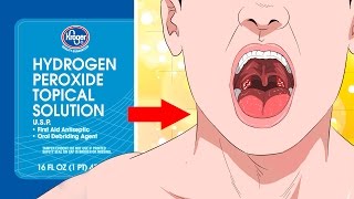 10 Surprising Uses For Hydrogen Peroxide YOU NEED TO KNOW [upl. by Stag136]