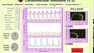 Cardiovascular Simulator Mechanically Assisted Circulation [upl. by Yasibit]