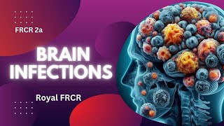 7  Neuroimaging for FRCR [upl. by Aitercal]