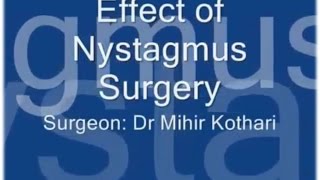 EffectsResults of a Nystagmus surgery [upl. by Eitisahc]