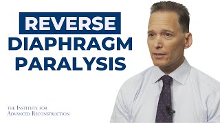 Diaphragm Paralysis Understanding Symptoms Diagnosis and Treatment [upl. by Morena]