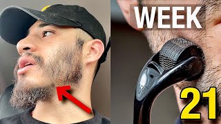 DERMAROLLER FAQ  Week 21 Minoxidil Beard Growth Journey WEEKLY UPDATE [upl. by Oiluig438]