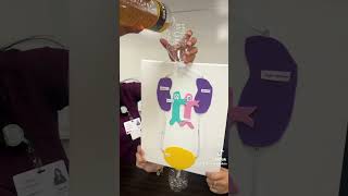 Urinary System Project Functional medicaleducation kidneysuretersbladderurethraurine [upl. by Ralaigh533]